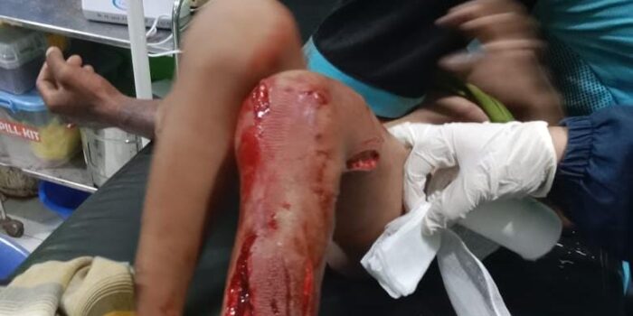 Aksi Heroik Warga Selamatkan Bocah 6 Tahun dari Terkaman Buaya di Sungai Mamolo Nunukan